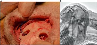 The Safety of Micro-Implants for the Brain